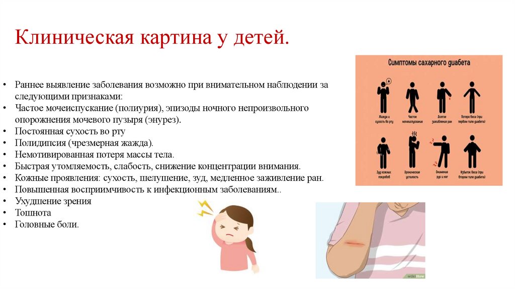 Клиническая картина у детей.