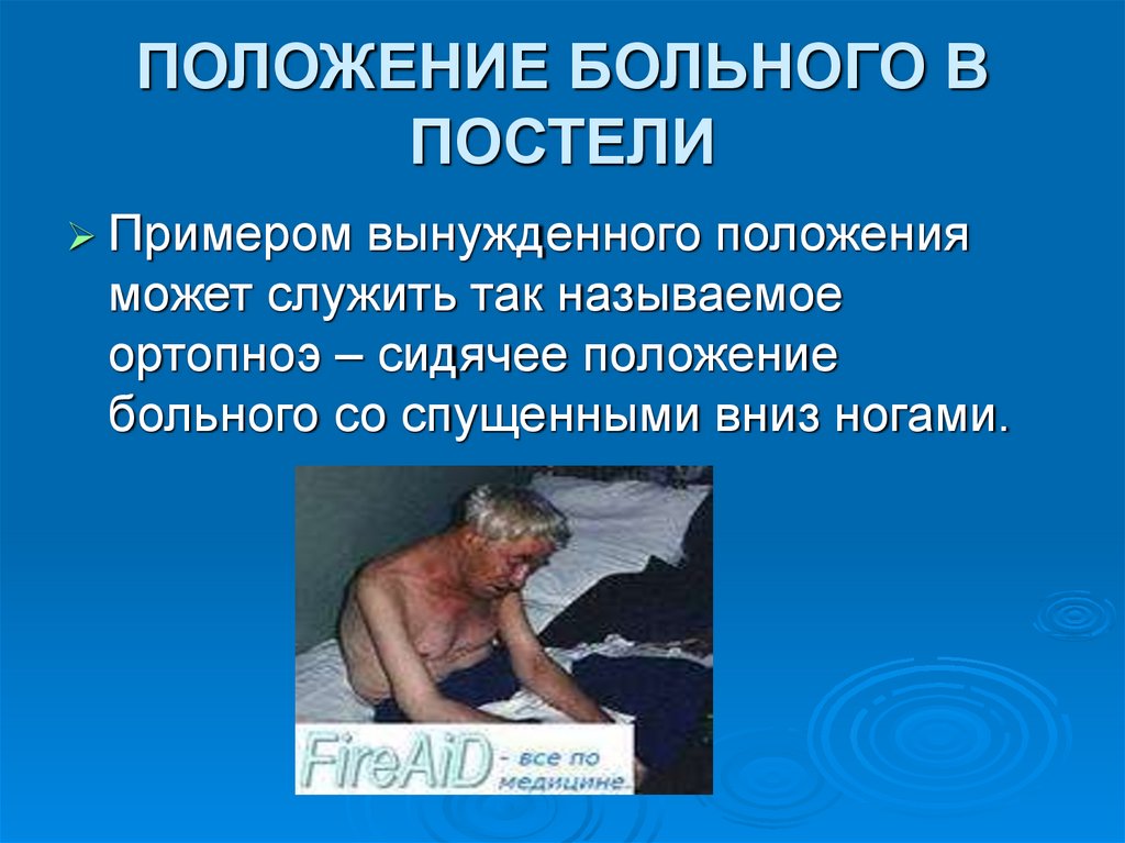 ПОЛОЖЕНИЕ БОЛЬНОГО В ПОСТЕЛИ