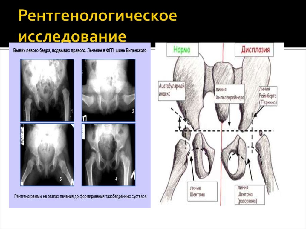 Рентгенологическое исследование