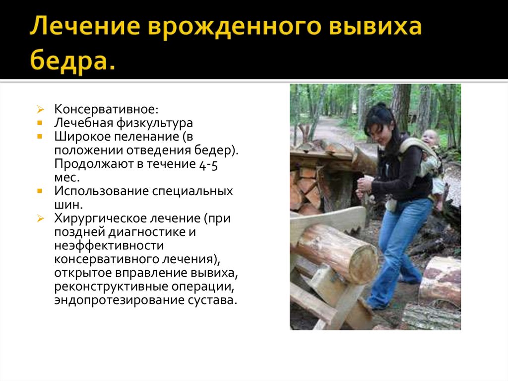 Лечение врожденного вывиха бедра.