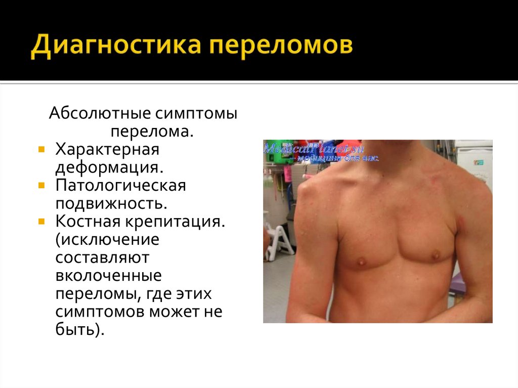 Диагностика переломов