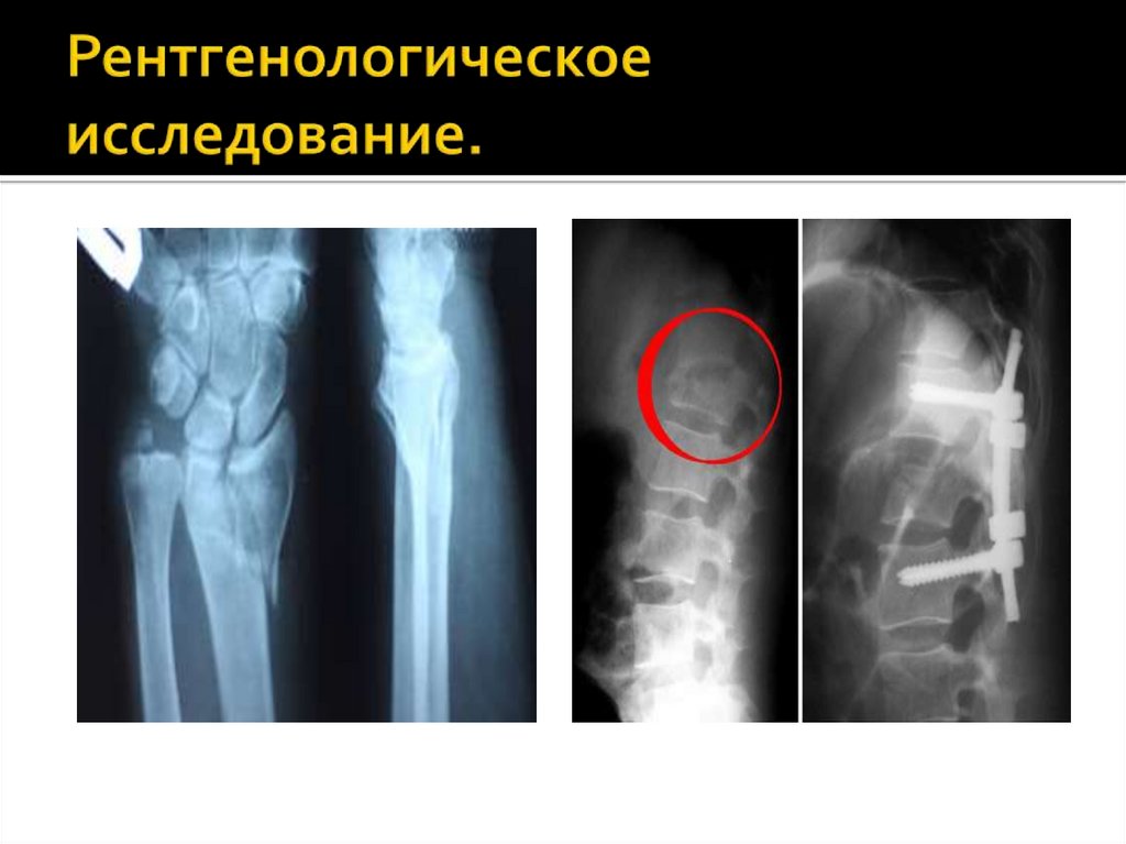 Рентгенологическое исследование.