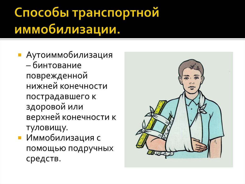 Способы транспортной иммобилизации.