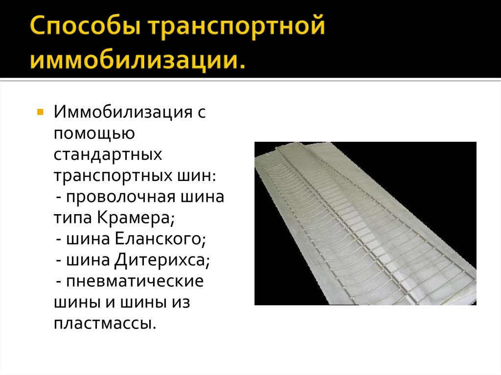Способы транспортной иммобилизации.