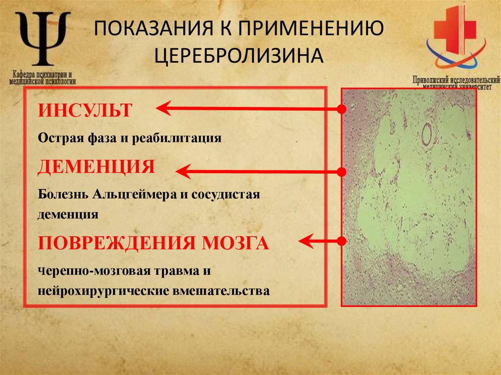 ПОКАЗАНИЯ К ПРИМЕНЕНИЮ ЦЕРЕБРОЛИЗИНА