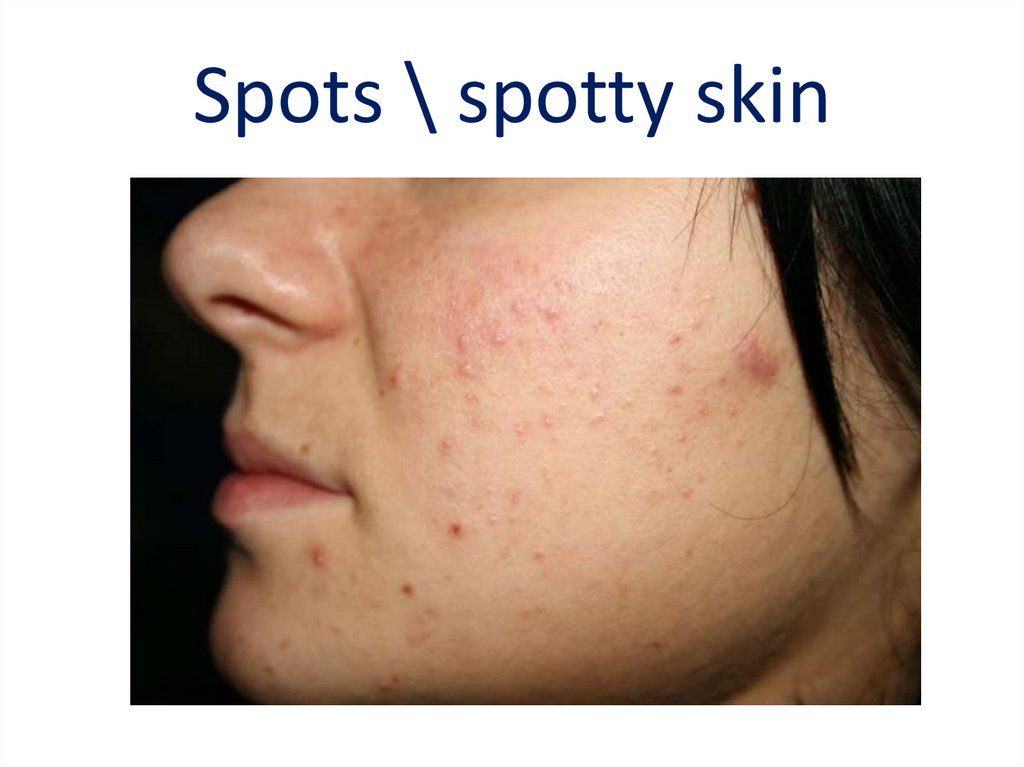 Spots \ spotty skin