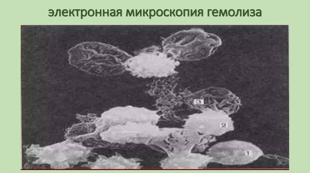 электронная микроскопия гемолиза