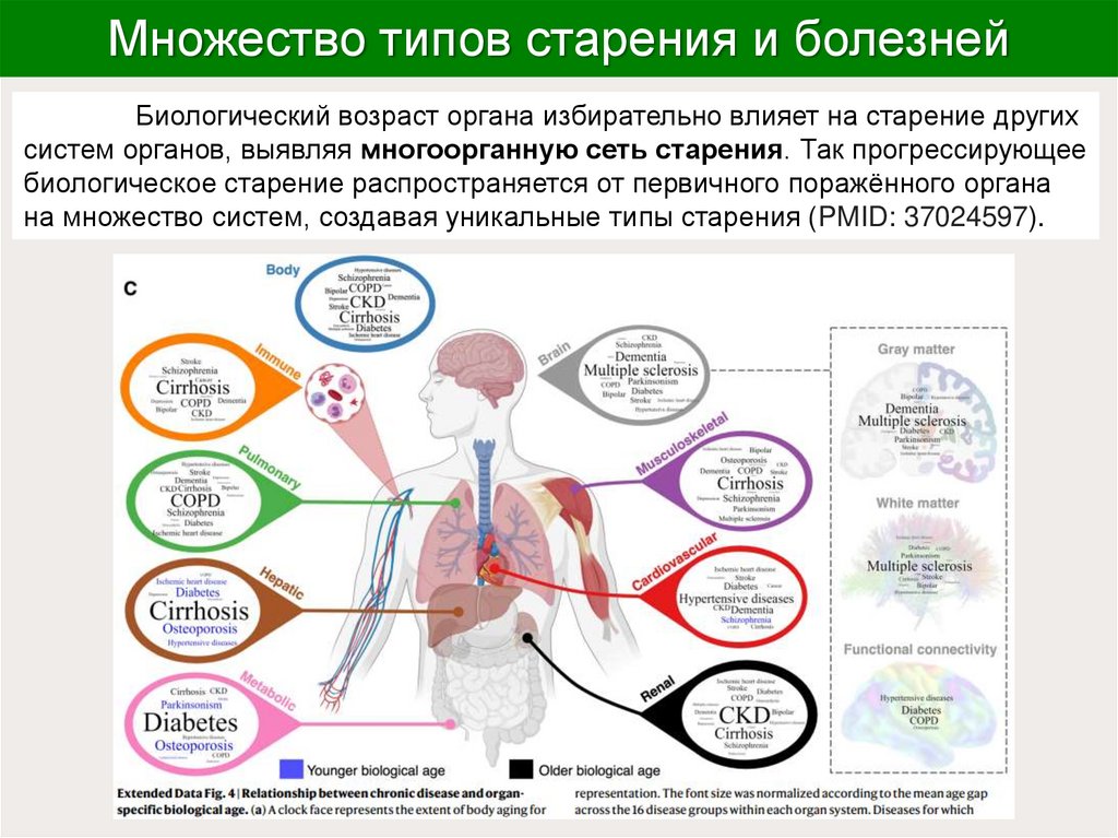 Множество типов старения и болезней