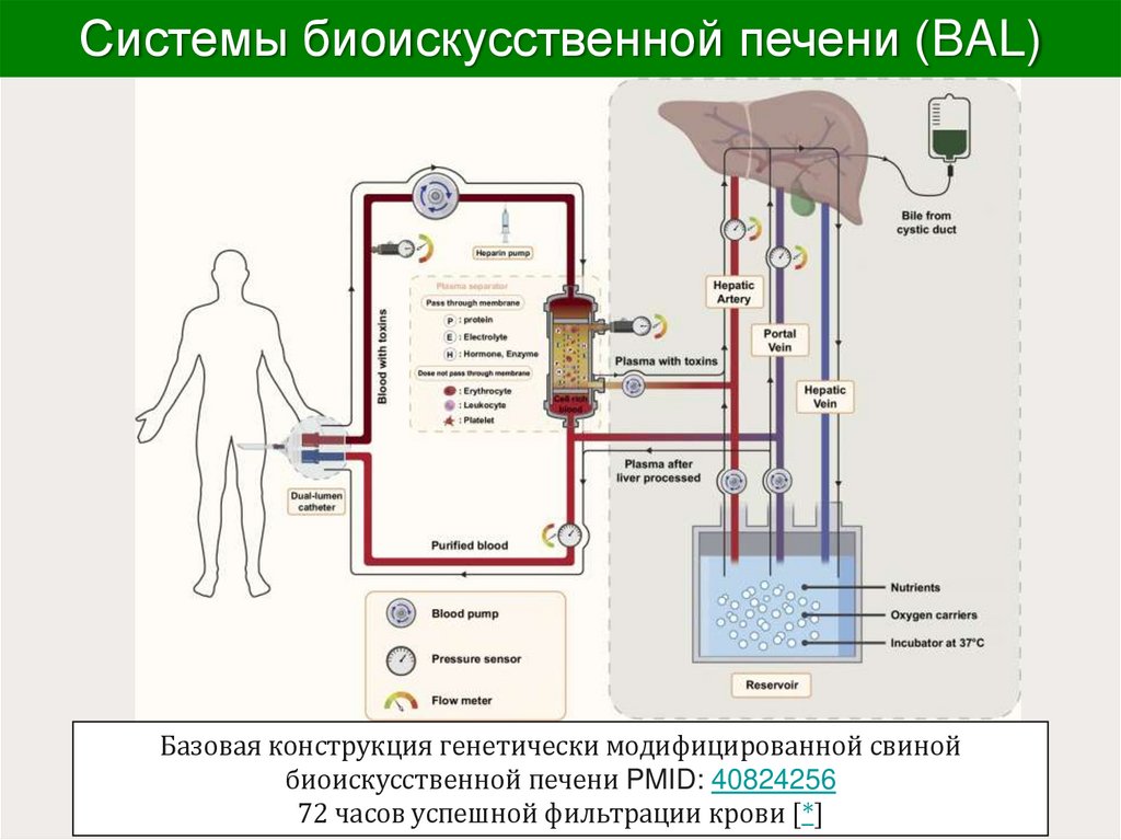 Системы биоискусственной печени (BAL)