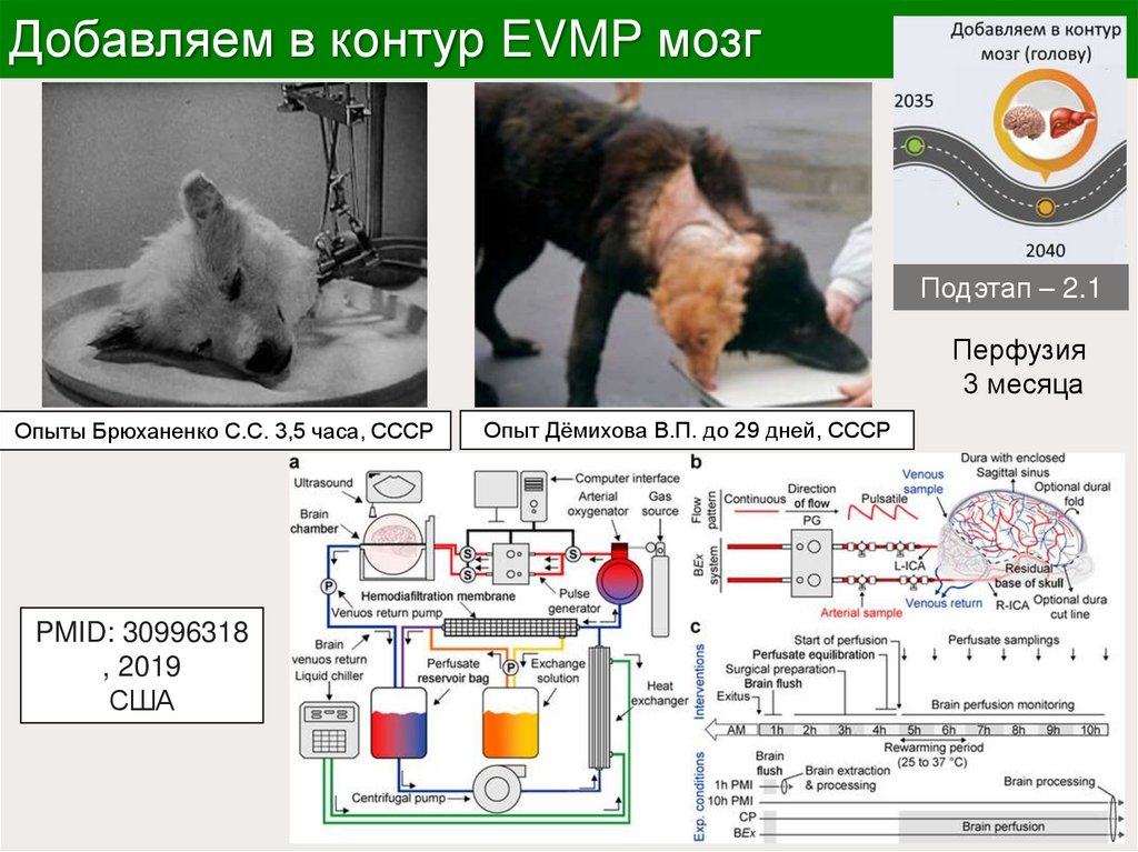 Добавляем в контур EVMP мозг
