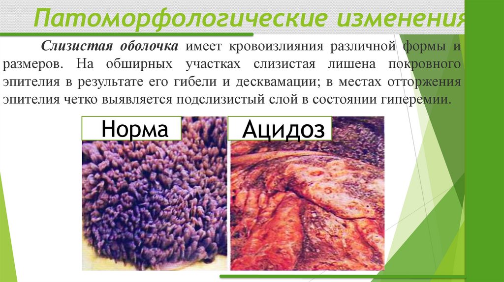 Патоморфологические изменения