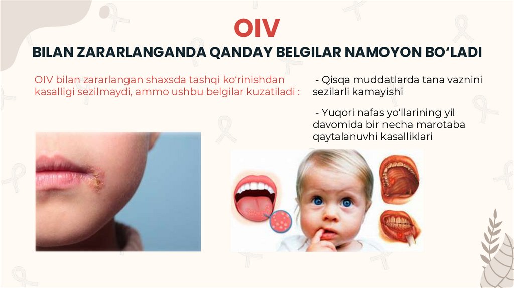 OIV BILAN ZARARLANGANDA QANDAY BELGILAR NAMOYON BO‘LADI