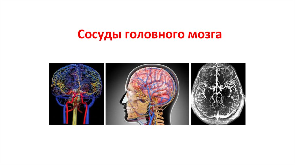 Сосуды головного мозга