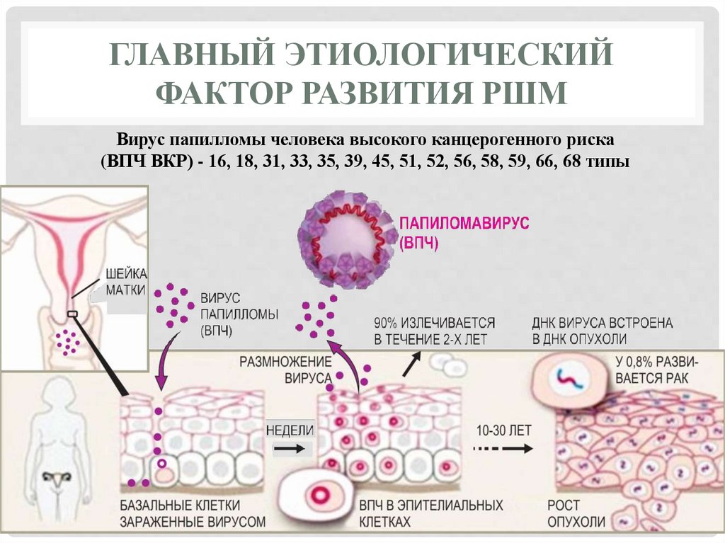 Главный этиологический фактор развития рШМ