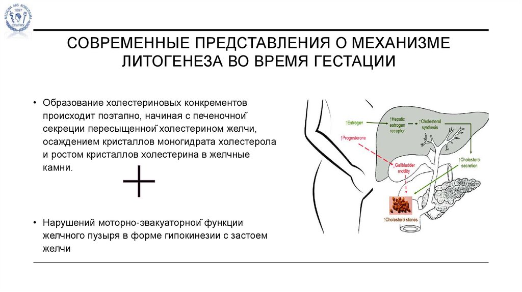 Современные представления о механизме литогенеза во время гестации