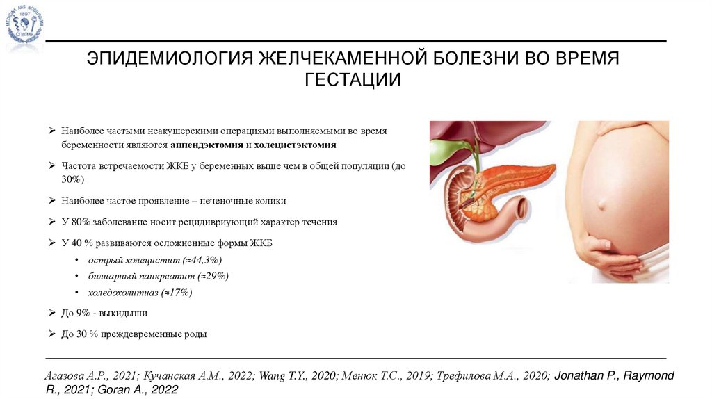 эпидемиология желчекаменной болезни во время гестации
