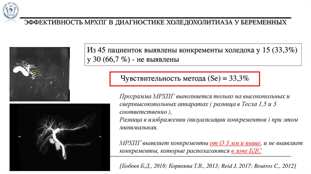 ЭФФЕКТИВНОСТЬ МРХПГ в диагностике холедохолитиаза у беременных