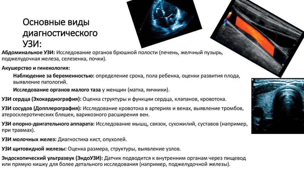 Основные виды диагностического УЗИ:
