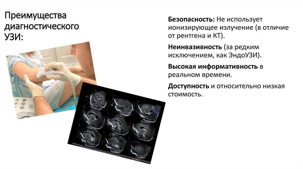 Преимущества диагностического УЗИ: