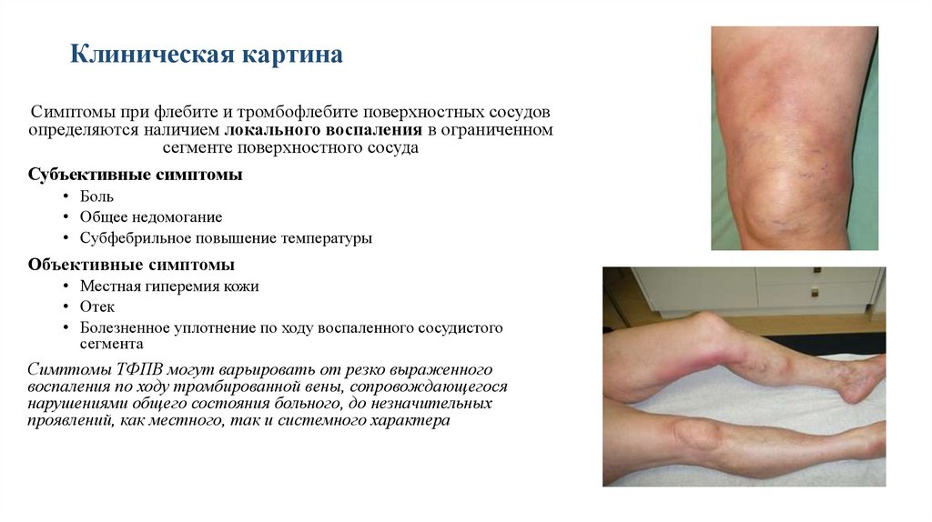 Клиническая картина