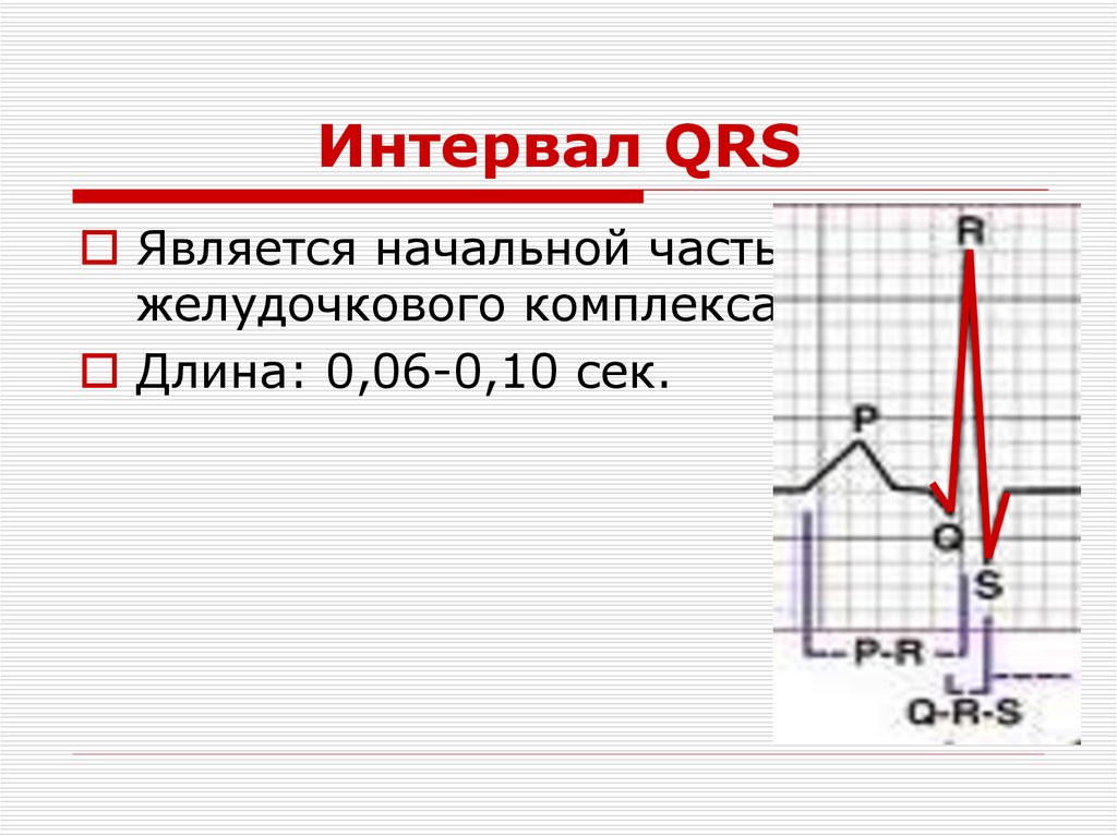 Интервал QRS