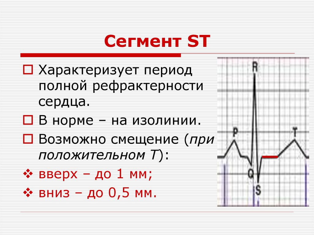 Сегмент ST