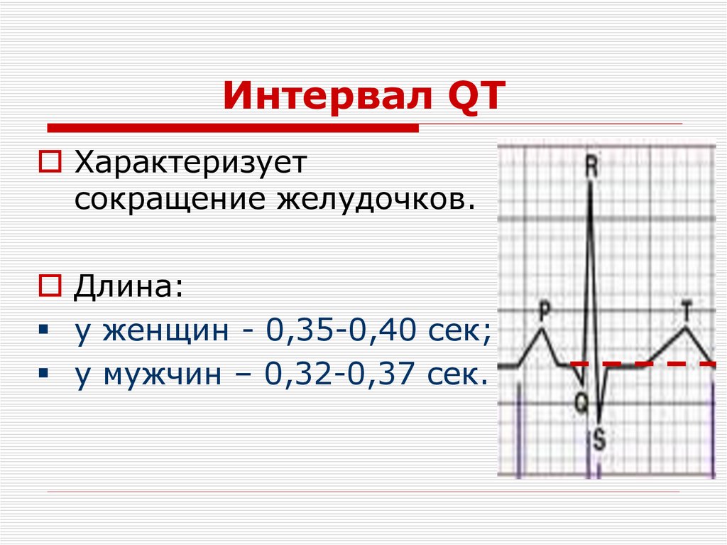 Интервал QT