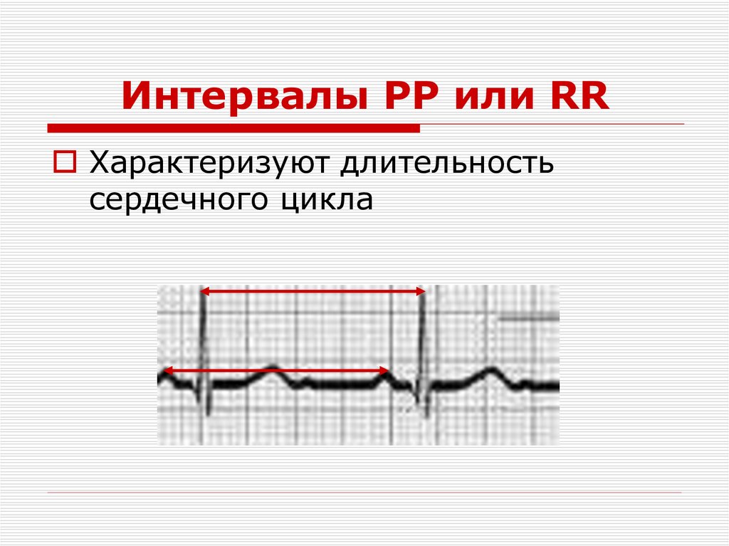 Интервалы PP или RR