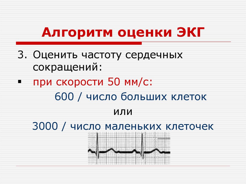Алгоритм оценки ЭКГ