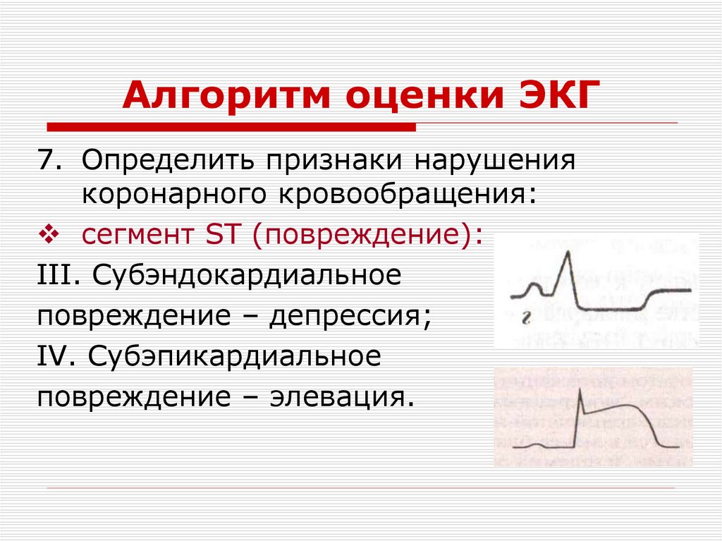 Алгоритм оценки ЭКГ