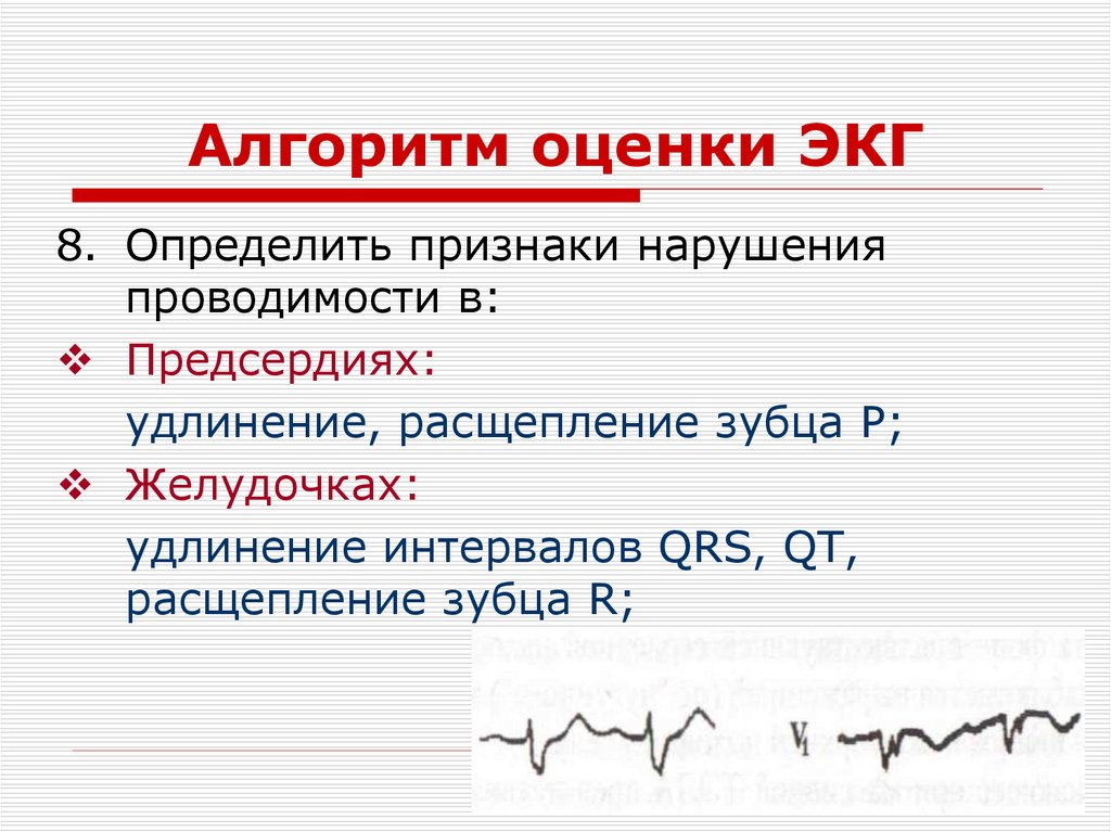 Алгоритм оценки ЭКГ
