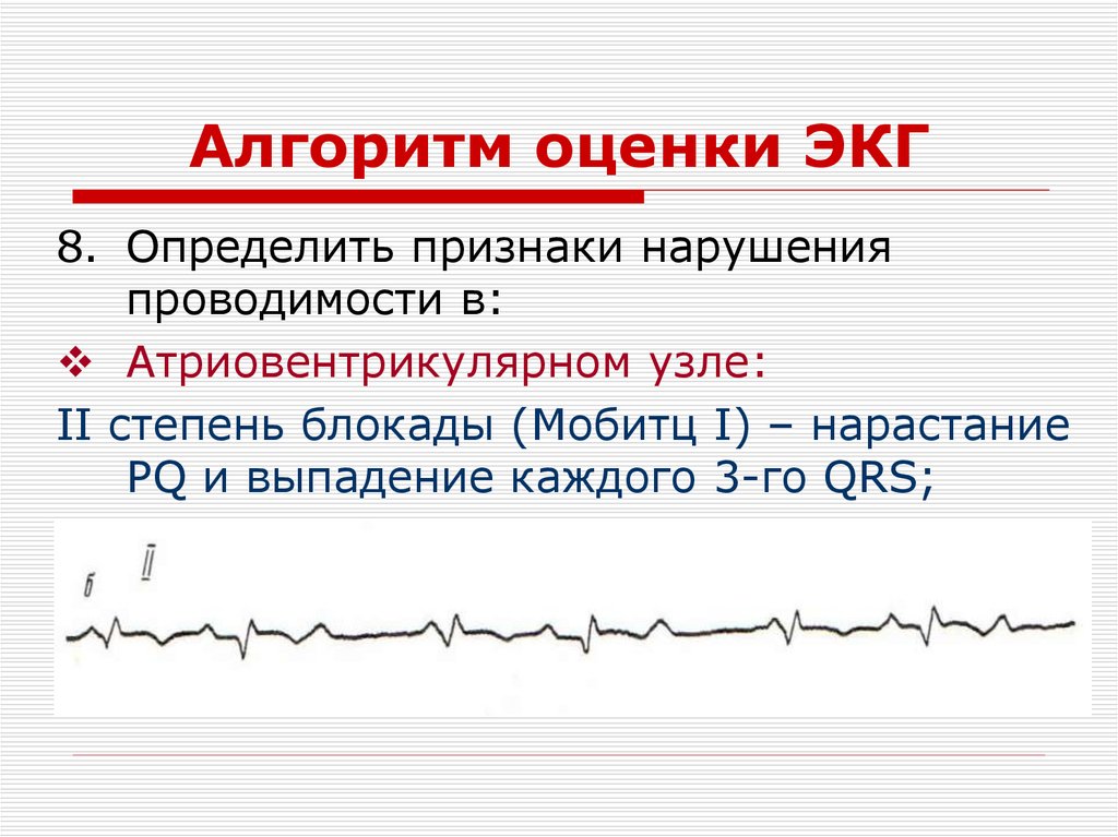 Алгоритм оценки ЭКГ