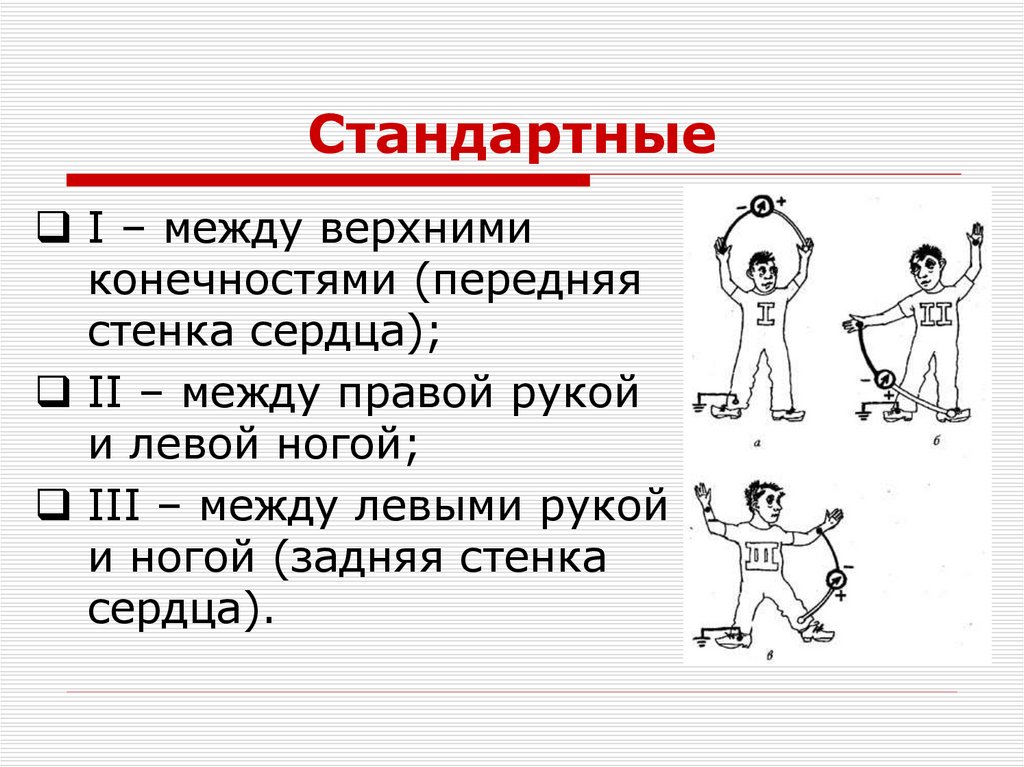 Стандартные