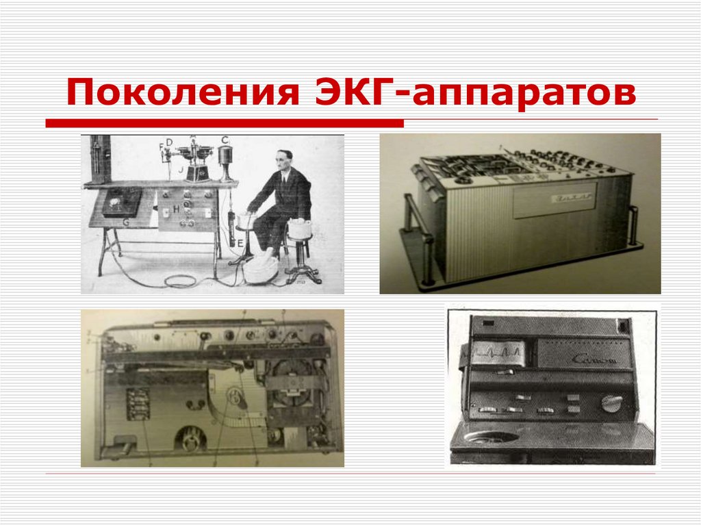 Поколения ЭКГ-аппаратов
