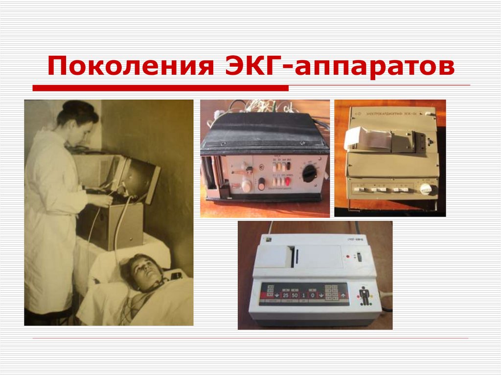 Поколения ЭКГ-аппаратов