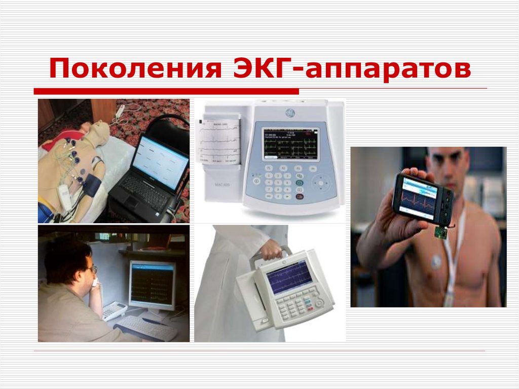 Поколения ЭКГ-аппаратов