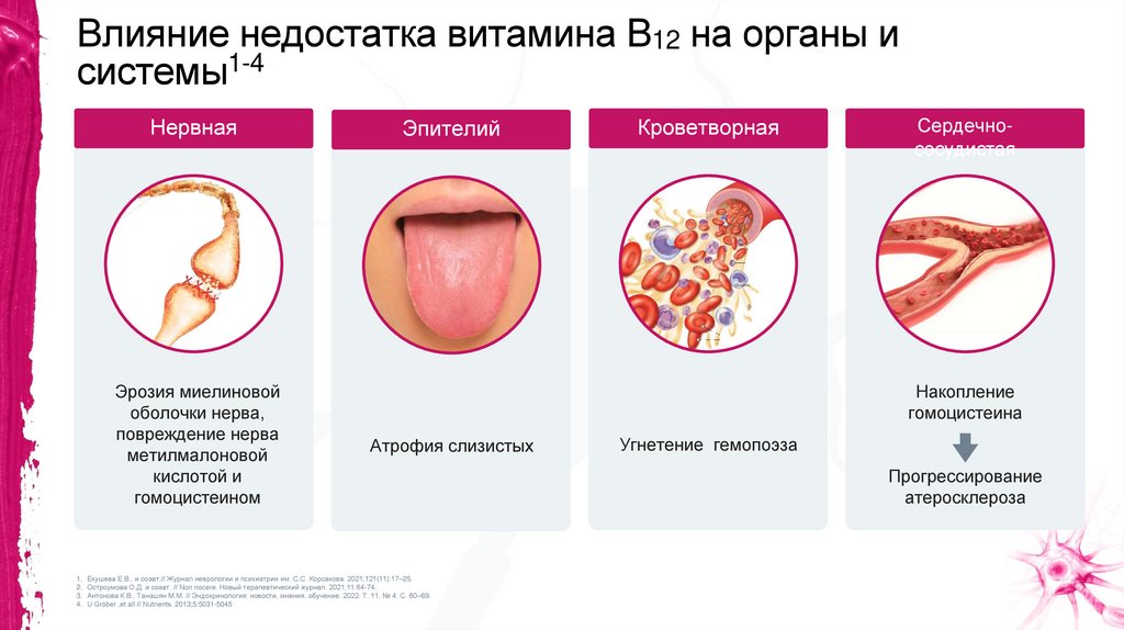 Влияние недостатка витамина В12 на органы и системы1-4