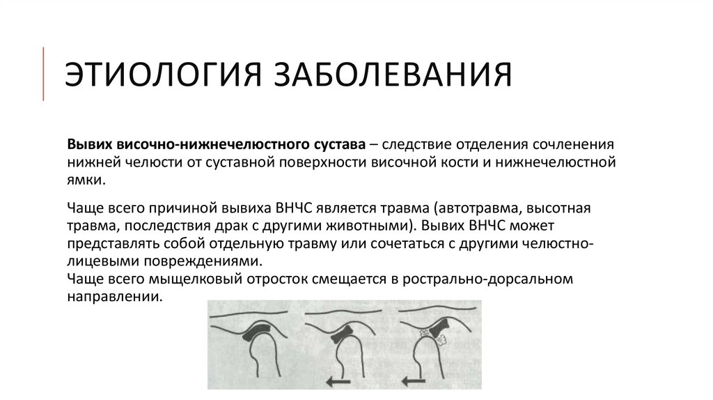 Этиология заболевания