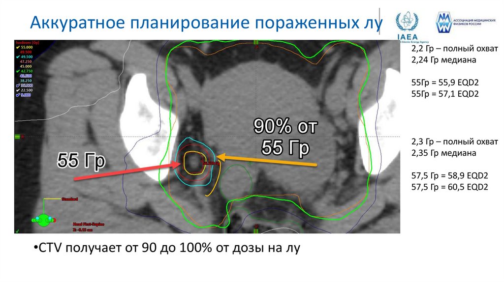 Аккуратное планирование пораженных лу