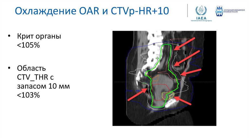 Охлаждение OAR и CTVp-HR+10