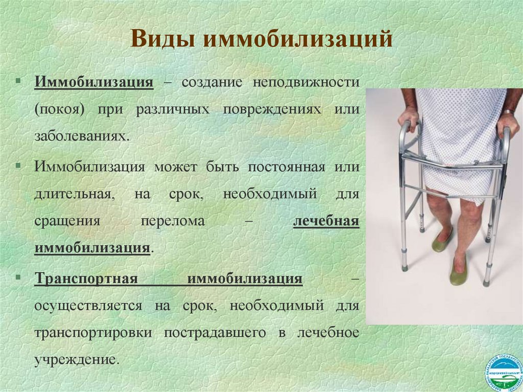 Виды иммобилизаций