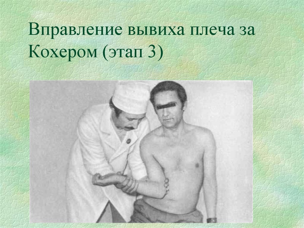 Вправление вывиха плеча за Кохером (этап 3)