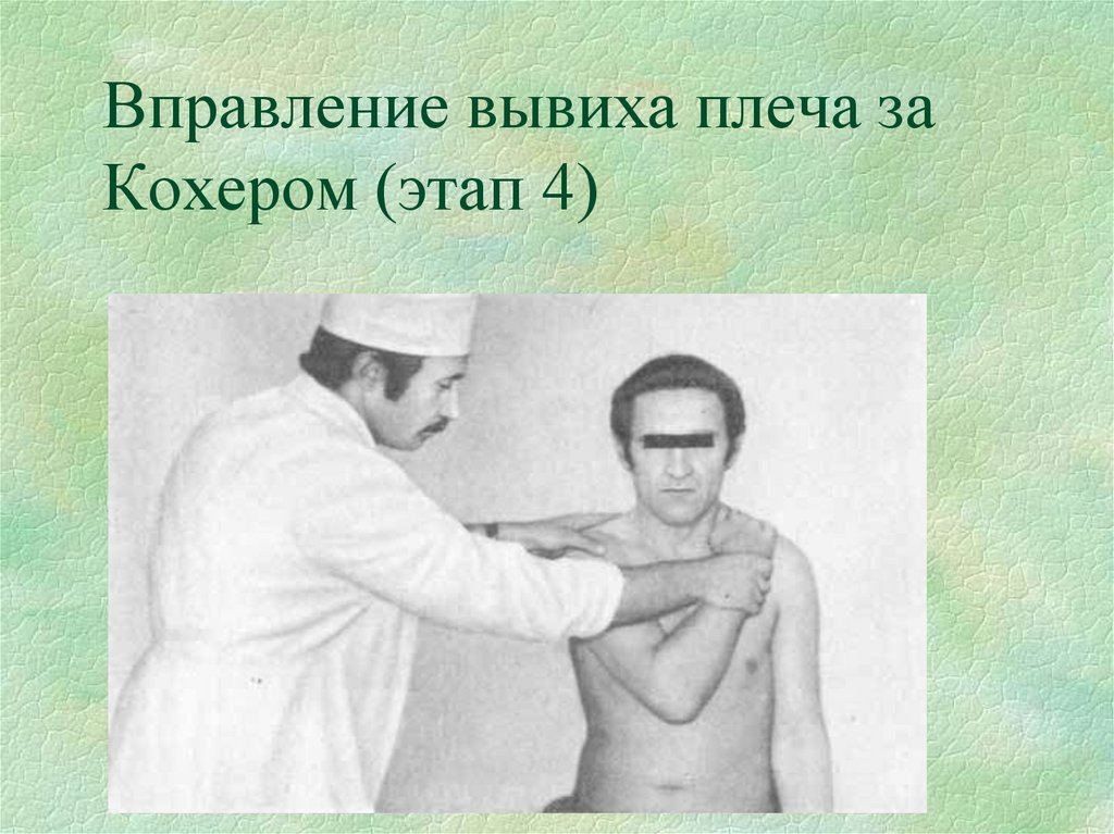 Вправление вывиха плеча за Кохером (этап 4)