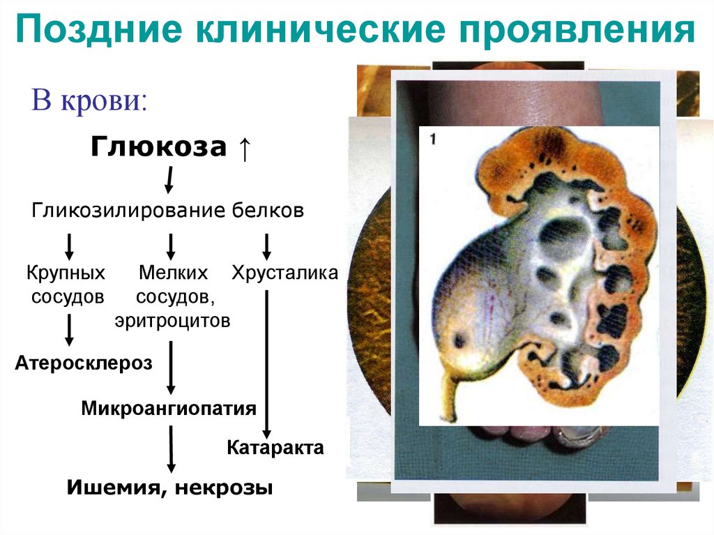 Поздние клинические проявления