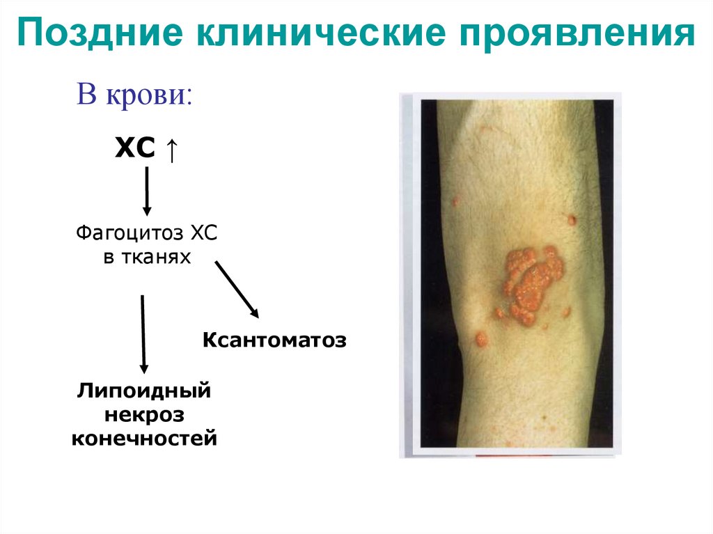 Поздние клинические проявления
