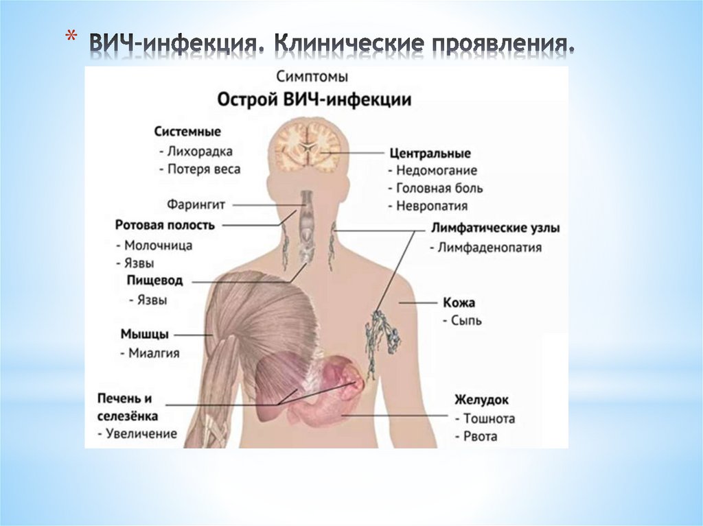 ВИЧ-инфекция. Клинические проявления.