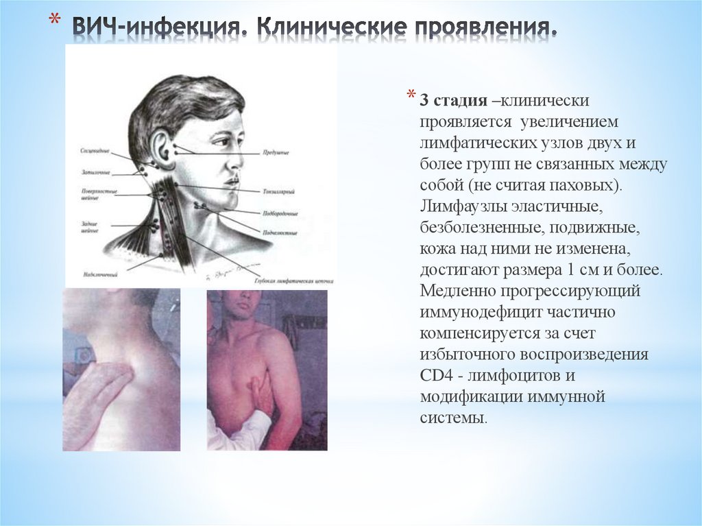 ВИЧ-инфекция. Клинические проявления.