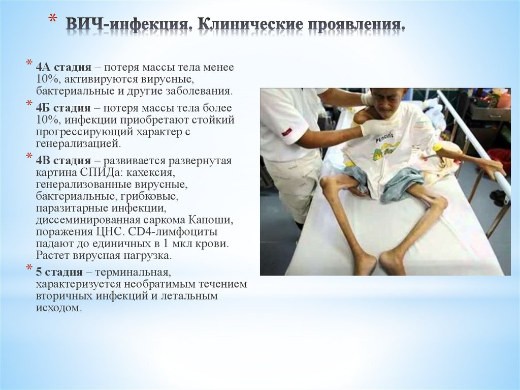ВИЧ-инфекция. Клинические проявления.