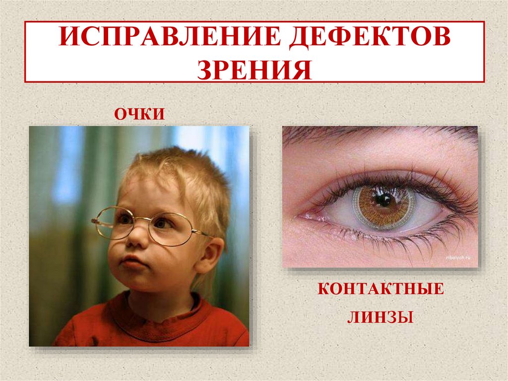 РАЗРЕШАЮЩАЯ СПОСОБНОСТЬ ГЛАЗА (ОСТРОТА) – φ0