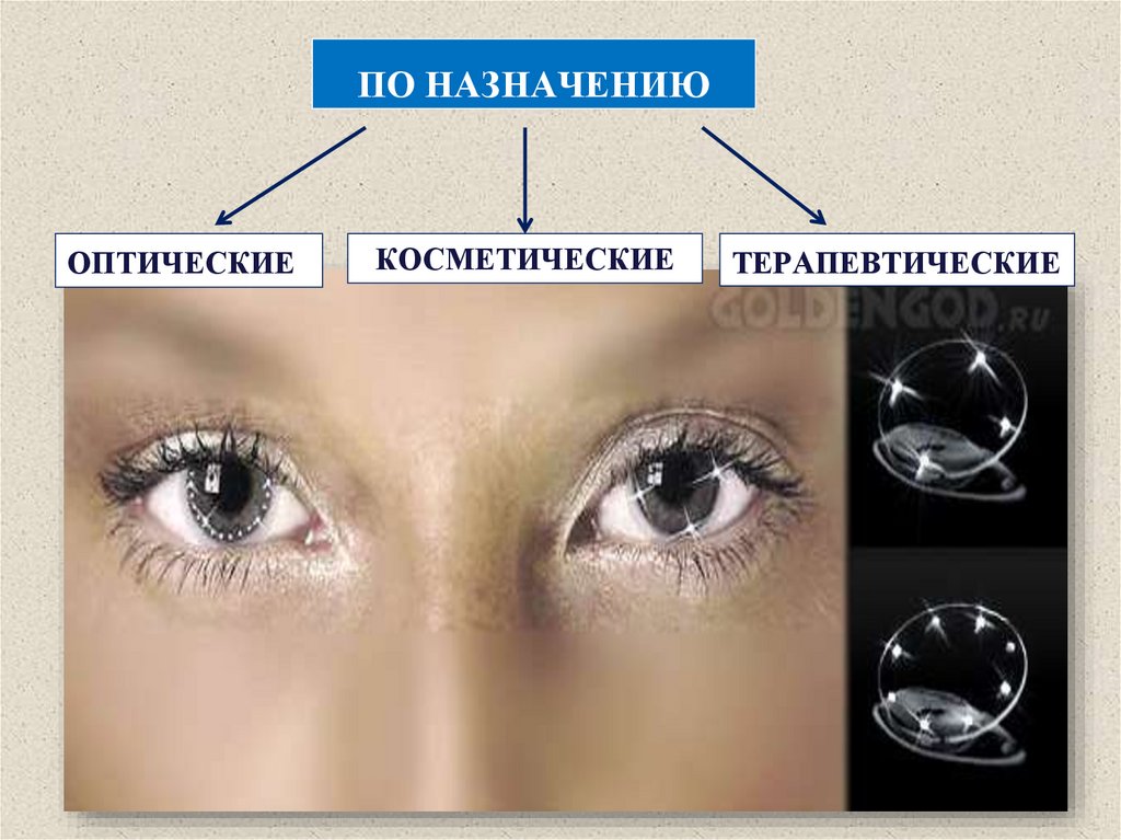 КЛАССИФИКАЦИЯ КОНТАКТНЫХ ЛИНЗ